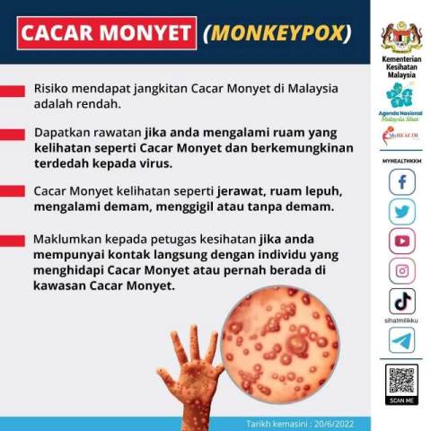 CACAR-MONYET-MONKEYPOX.jpg